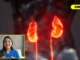17 Signs of Kidney Disease You Can See